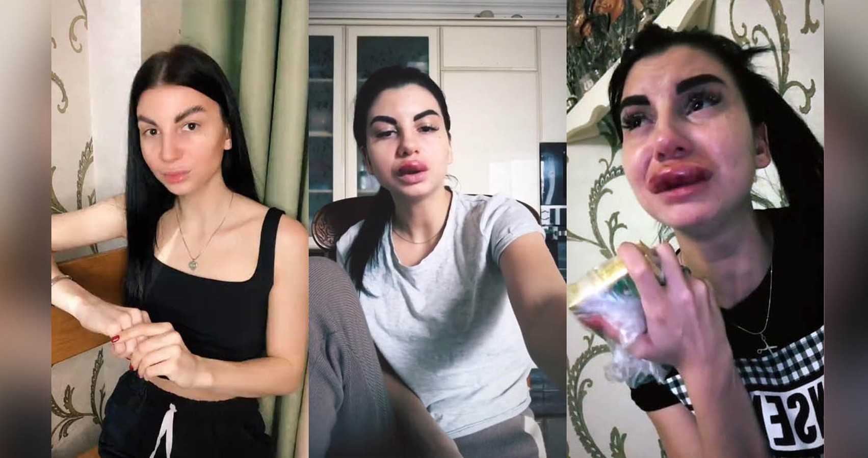 Такие юные, а уже все "переделанные": 10 звёзд, подправивших себя у хирурга | кто?что?где?
