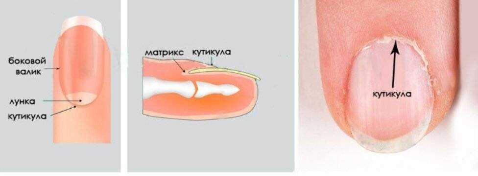 Тонкая кутикула. очень часто возникает вопрос что делать с тонкой налипшей кутикулой, которую не отдерешь с ногтя и которая кровоточит при любом не ловком движении? | маникюр