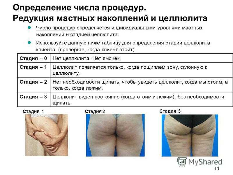Диета против целлюлита: что нельзя, а что можно