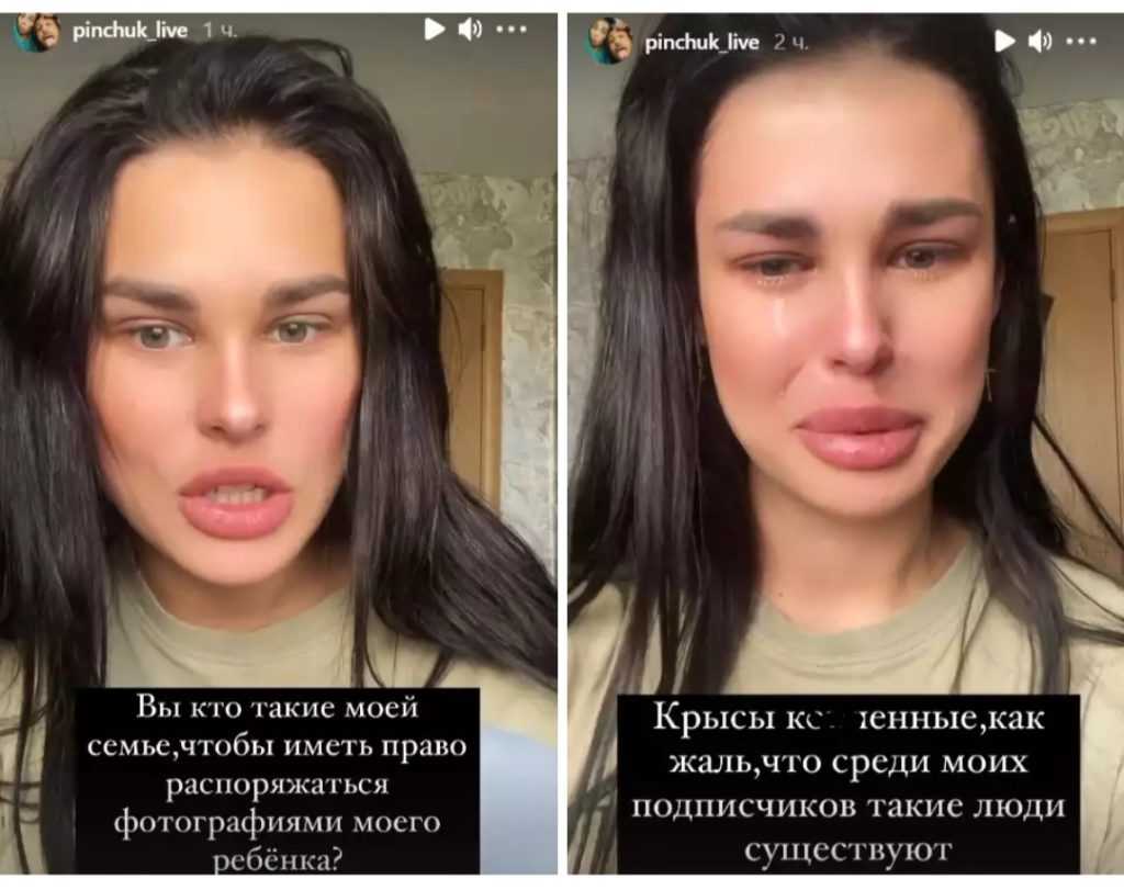 Ирина пинчук до и после пластики (фото)