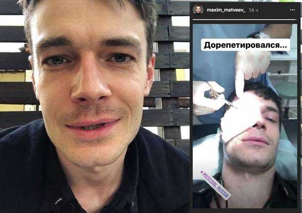 Максим матвеев: почему актер похудел так сильно