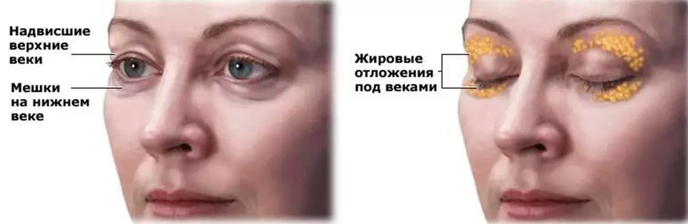 Настя ивлеева рассказала о своей пластике (фото)