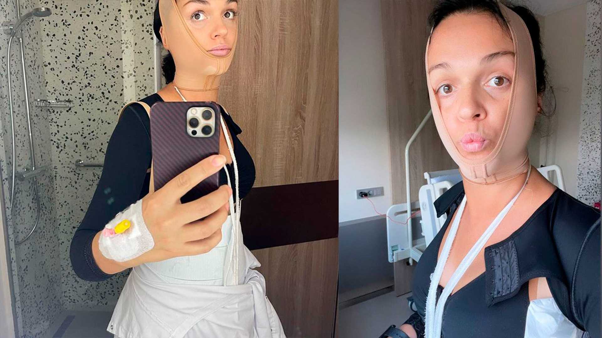Невеста ивлева показала себя до пластики