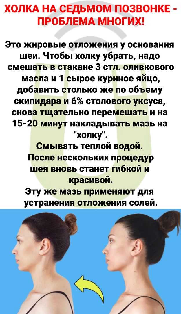 Вдовий горбик упражнения чтобы убрать: лучшие упражнения и массаж для удаления «вдовьего горба»