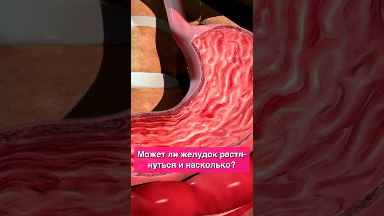 Перфорация язвы желудка: причины, симптомы, лечение