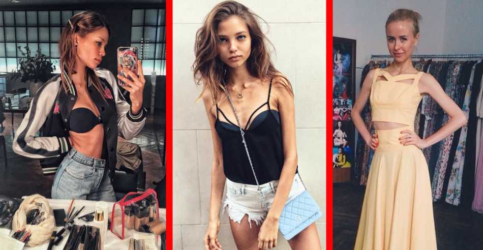20+ звезд, которые почувствовали на себе, что такое анорексия