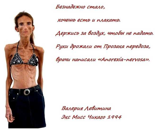 Анорексия - причины, симптомы, стадии | клиника rehab family