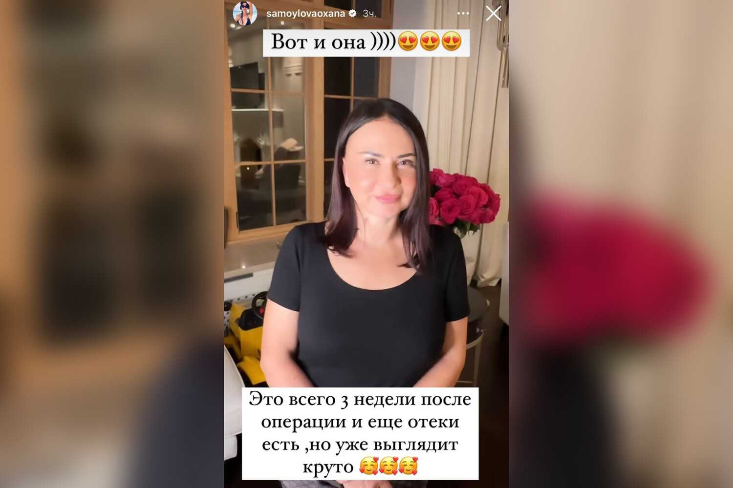Оксана самойлова показала фигуру после родов и рассказала о восстановлении. оксана самойлова показала фигуру после родов и рассказала о восстановлении оксана самойлова почему кесарево сечение