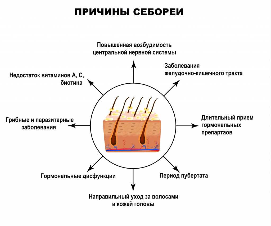 Быстро пачкаются волосы: причины и решение проблемы