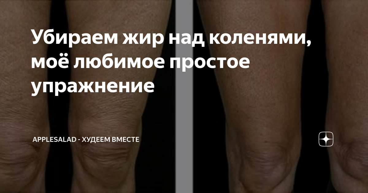 Как убрать жир с коленей? убираем жир на коленках за 60 минут без операции!