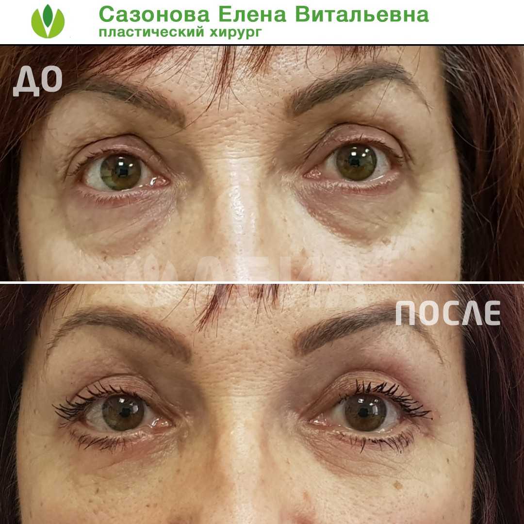 Телеведущая высказалась о своей внешности Настя Ивлеева отметила что ее лицо сильно изменилось в последнее время
