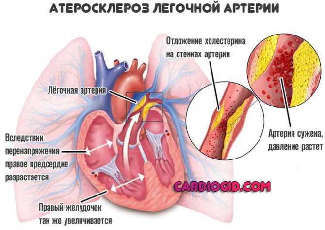 Почему никому не нужно тренировать сердце