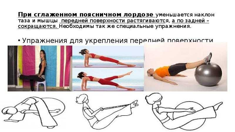 Гиперлордоз усиленный прогиб в пояснице встречается примерно у половины людей с лишним весом Из за него многие упражнения упражнения становая тяга утрачивают свою эффективность Откуда берется это нарушение осанки как его лечить и как с ним тр