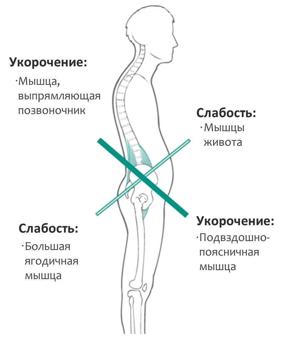 Сидячие болезни: как их избежать?