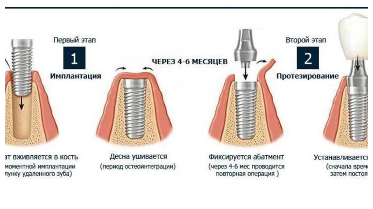 В последний раз евгений петросян выходил на связь с аудиторией 15 февраля. он сообщил, что концерт, назначенный на 2 марта, обязательно состоится. ранее рассказывал, что брухунова впервые ответила на новости о состоянии петросяна.