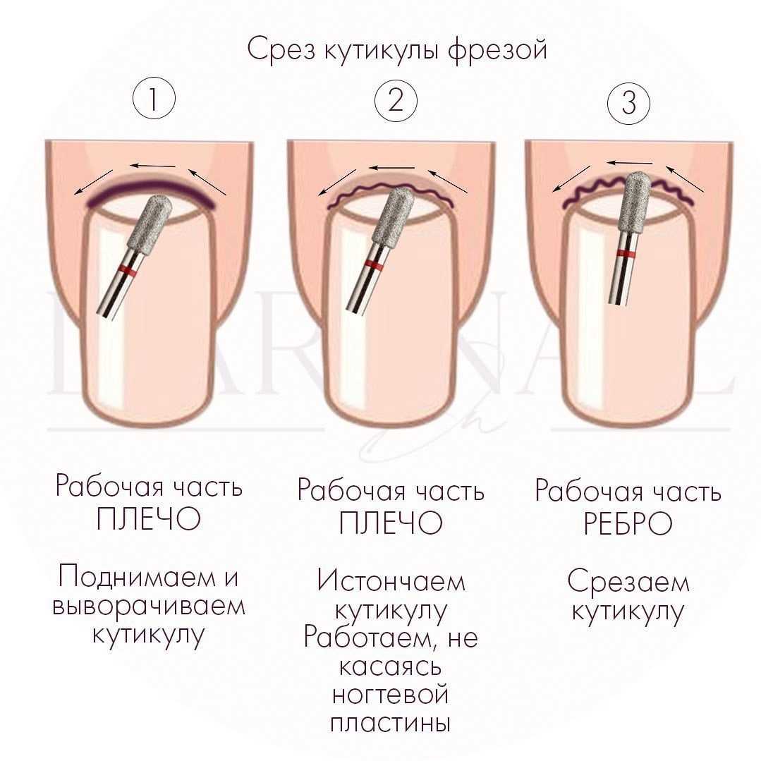 Методы удаления кутикулы