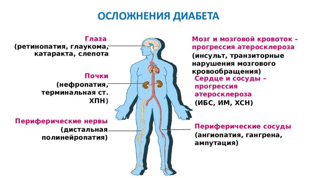 Вред сахара и его влияние на организм