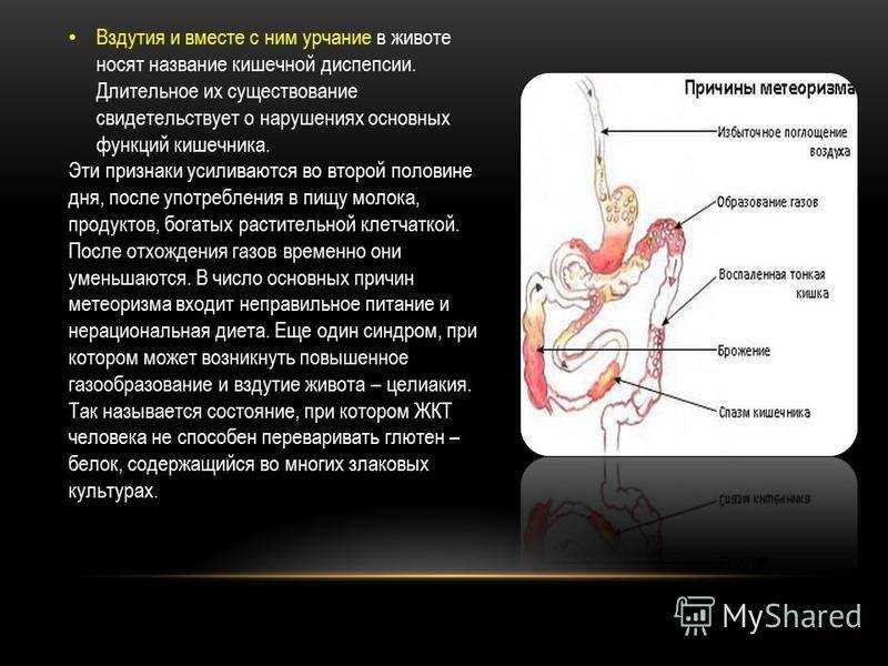 Почему постоянно урчит в животе, как с этим бороться, препараты