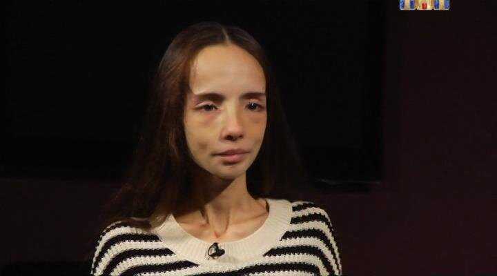 Героиня битвы экстрасенсов катя яковлева. анорексичка катя яковлева: что с ней сейчас? ведьма мэрилин керро спасла от неминуемой смерти девушку, страдающую анорексией