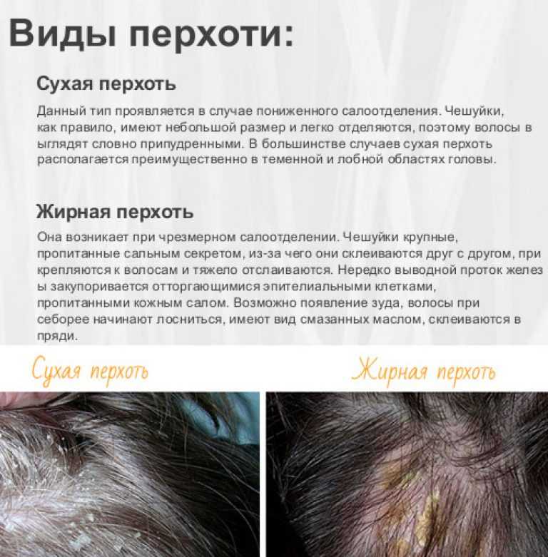 Hothair.ru - почему волосы быстро становятся жирными и как с этим бороться?