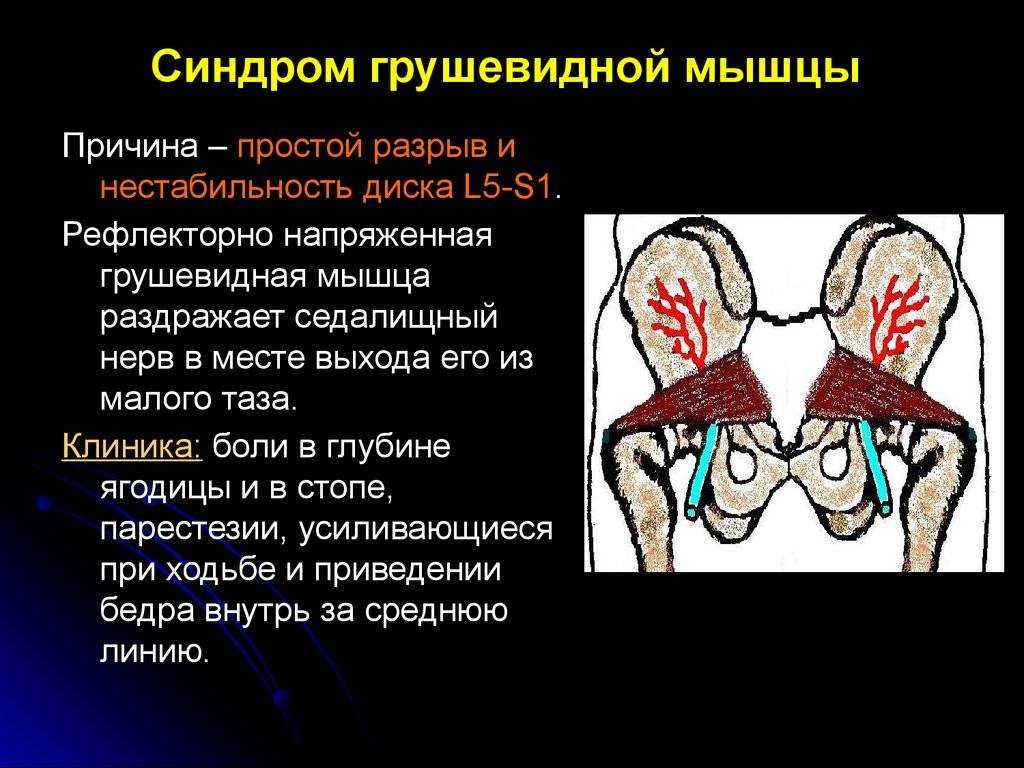 12 страшных вещей, к которым может привести сидячий образ жизни