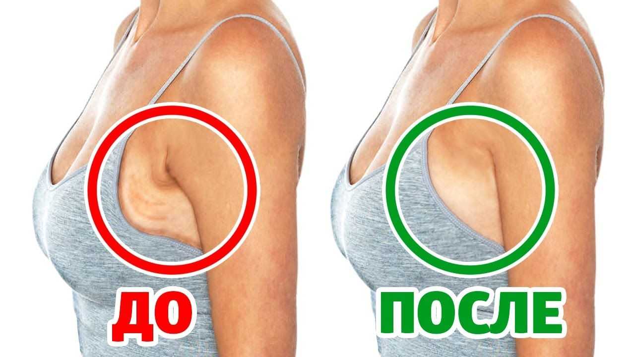 Как убрать жир в области подмышек: упражнения для похудения