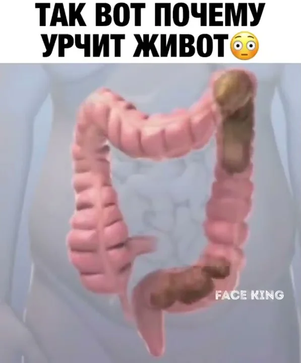 Почему урчит в животе и что с этим делать?