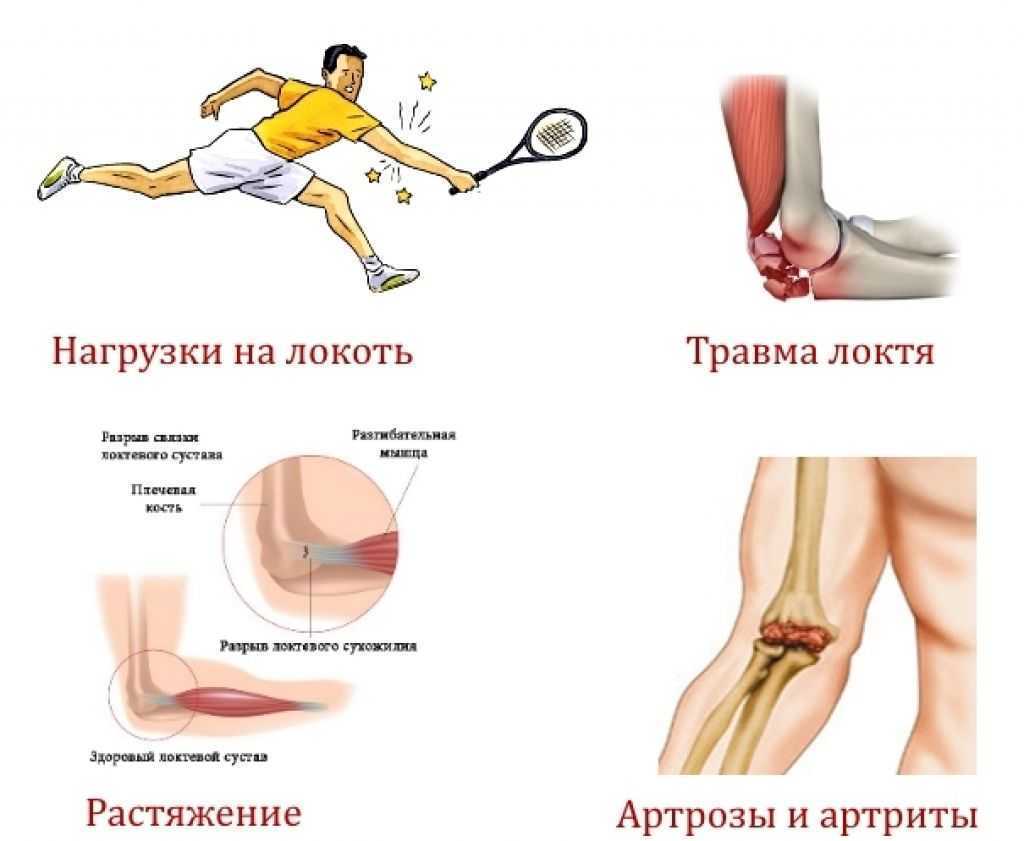 Болят мышцы после тренировки | боль после физической нагрузки - что делать?