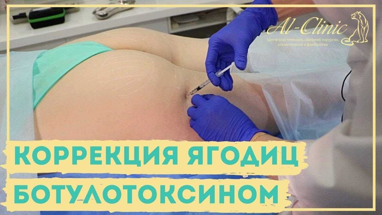 Джозелин Кано решила улучшить бедра в Колумбии Модель скончалась в результате неудачной операции