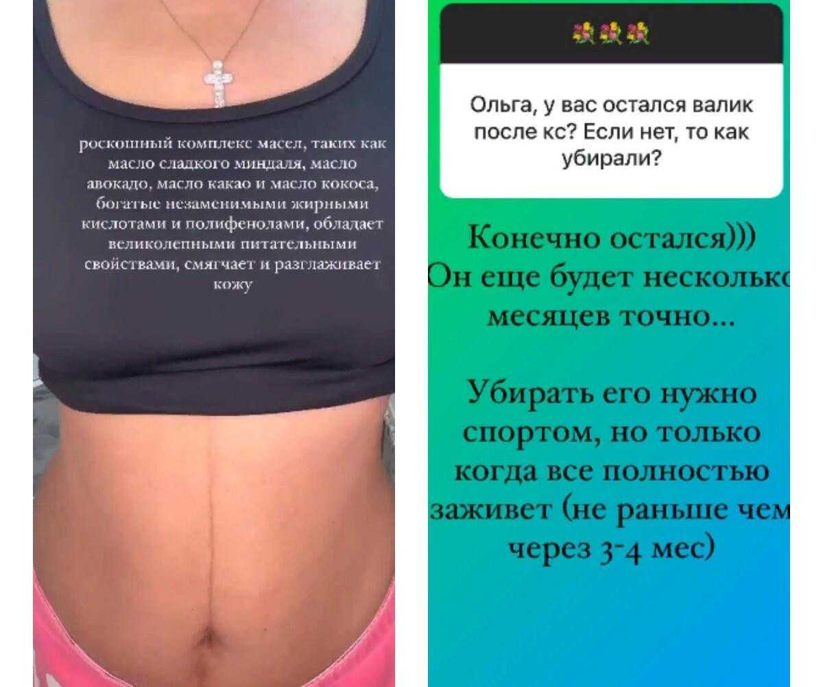 Как изменилась ольга орлова