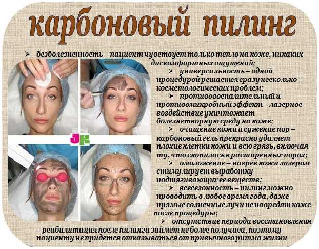 Карбоновый пилинг для лица: что это такое, польза, эффект и противопоказания