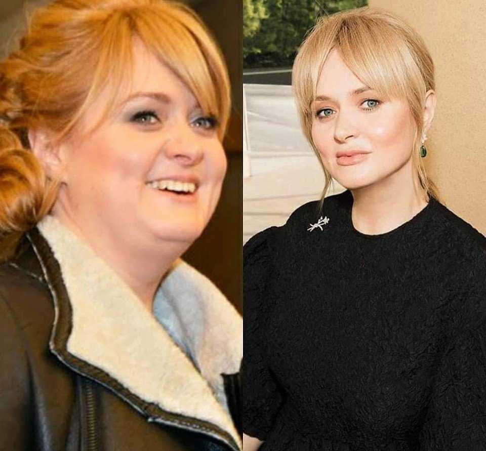Анна михалкова похудела фото до и после