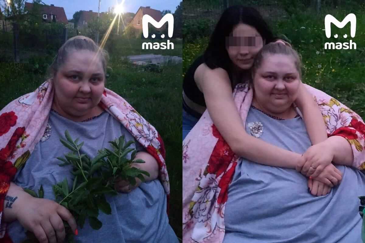 30 летняя Ксения Мохова из Калининграда страдает из за лишнего веса Женщина не смогла вылететь на операцию в Санкт Петербург