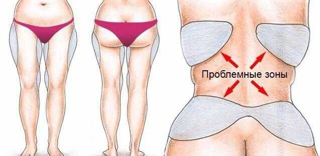 Проблемные зоны: почему появляются и как бороться?