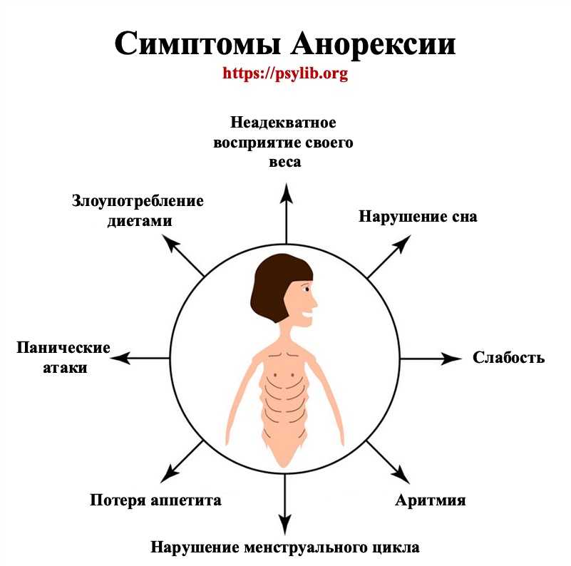 Балерина ест два вареных яйца в день У нее развита нервная анорексия уверен эксперт